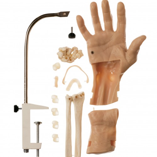 Αρθροσκοπικό μοντέλο του καρπού