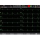Ηλεκτροκαρδιογράφος εξακάναλος SE-601 B