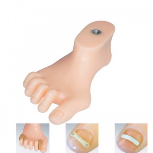 ﻿Ομοίωμα άκρου ποδός