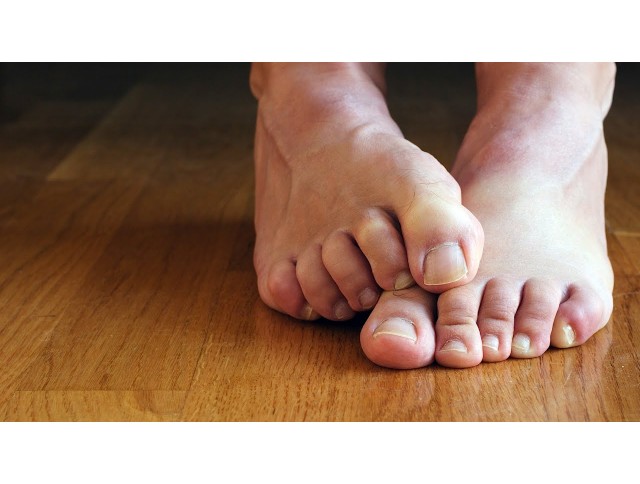 Γαμψοδακτυλία Γαμψοδακτυλία