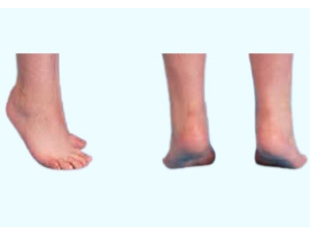 Ιπποποδία Ιπποποδία