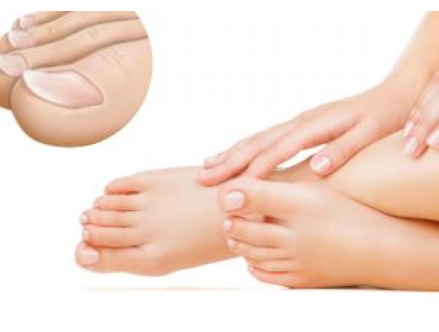 Κοιλονυχία