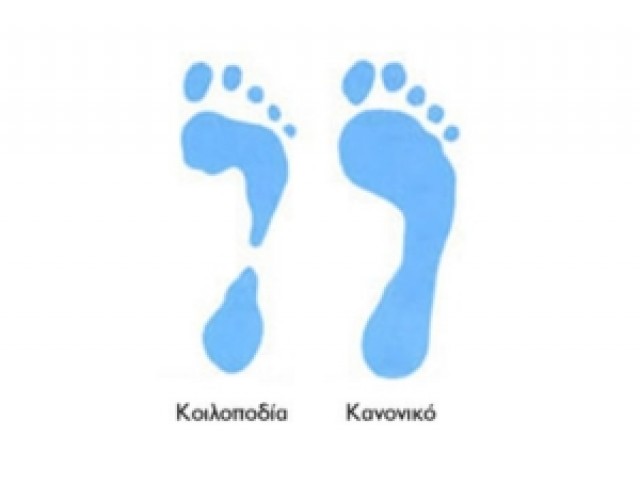 Κοιλοποδία