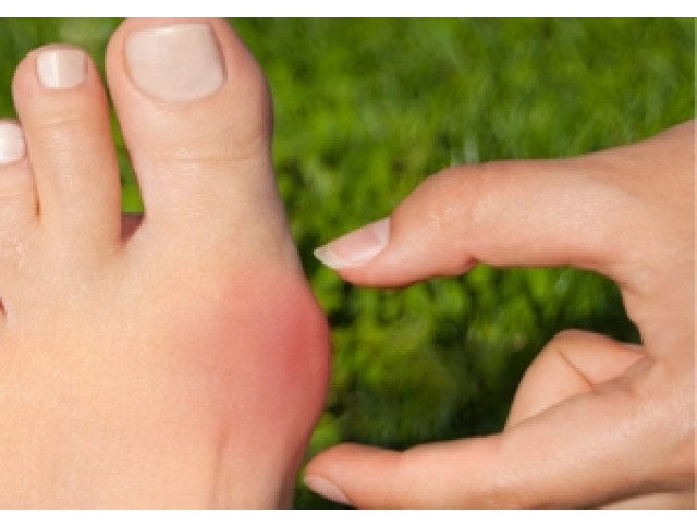 Κότσι- Βλαισός Μέγας Δάκτυλος Κότσι- Βλαισός Μέγας Δάκτυλος