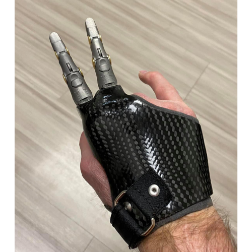 Πρόθεση δακτύλων μηχανική ή πρόθεση τμημάτων παλάμης μηχανική Πρόθεση δακτύλων μηχανική ή πρόθεση τμημάτων παλάμης μηχανική