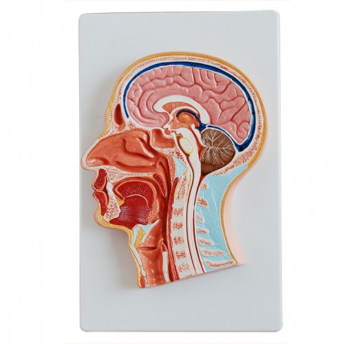 Πρόπλασμα  κεφαλής σε εγκάρσια διατομή Πρόπλασμα  κεφαλής σε εγκάρσια διατομή