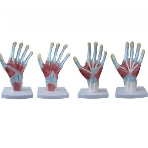 Πρόπλασμα ανατομίας παλάμης Πρόπλασμα ανατομίας παλάμης