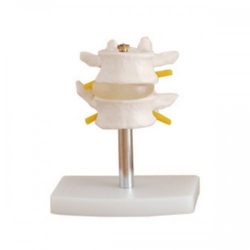 Σετ οσφυϊκών σπονδύλων (2 σπόνδυλοι)