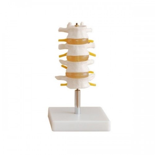 Σετ οσφυϊκών σπονδύλων (4 σπόνδυλοι)