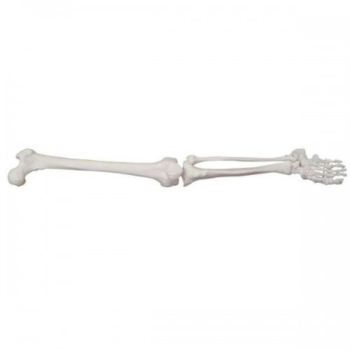 Πρόπλασμα Κάτω Άκρου