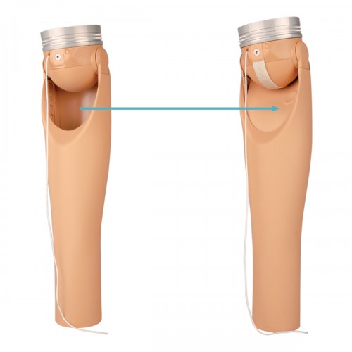 Μηχανικός αγκώνας Ottobock 12K42 ErgoArm plus Μηχανικός αγκώνας Ottobock 12K42 ErgoArm plus