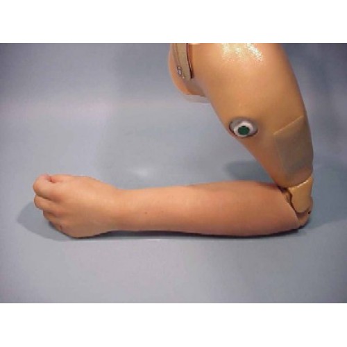 Πρόθεση βραχιονίου ή απεξάρθρωσης αγκώνα ηλεκτρονική Πρόθεση βραχιονίου ή απεξάρθρωσης αγκώνα ηλεκτρονική