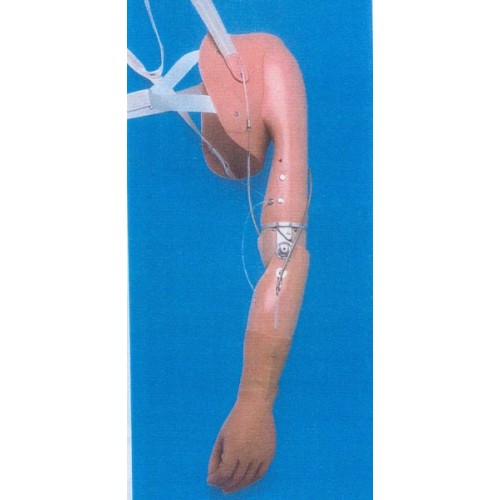 Πρόθεση  ώμου - απεξάρθρωσης βραχιονίου μηχανική