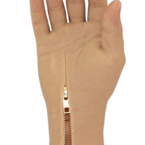 Πρόθεση τμήματος παλάμης Πρόθεση τμήματος παλάμης