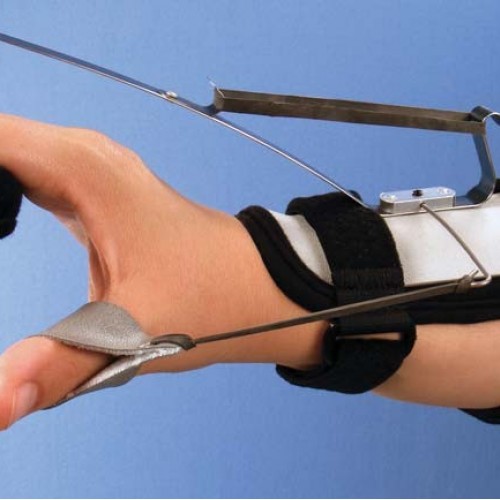 Δυναμικός νάρθηκας  έκτασης καρπού-έκτασης των μετακαρπίων Δυναμικός νάρθηκας  έκτασης καρπού-έκτασης των μετακαρπίων