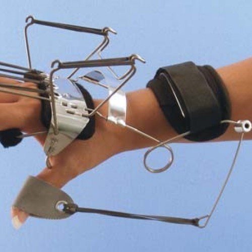 Νάρθηκας έκτασης καρπού, έκτασης μετακαρπ. με έλεγχο των δακτύλων  Νάρθηκας έκτασης καρπού, έκτασης μετακαρπ. με έλεγχο των δακτύλων