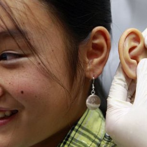 Πρόθεση αυτιού Πρόθεση αυτιού