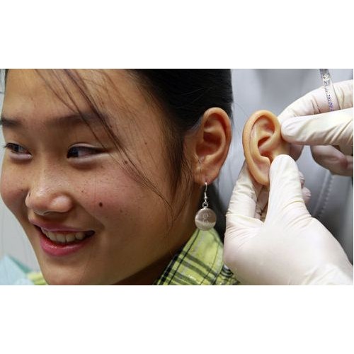 Πρόθεση αυτιού