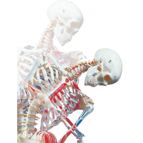 Πρόπλασμα σκελετού τύπου Deluxe SAM, σε σταντ 5 ποδιών με ροδάκι