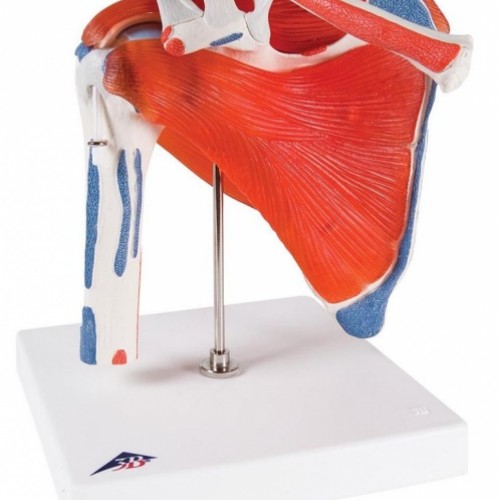 Πρόπλασμα άρθρωσης ώμου με περιστρεφόμενη άρθρωση, 5 τμημάτων