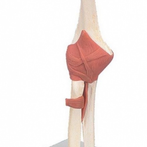 Πρόπλασμα λειτουργικής άρθρωσης αγκώνος τύπου Deluxe Πρόπλασμα λειτουργικής άρθρωσης αγκώνος τύπου Deluxe