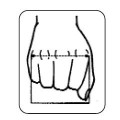 Δυναμικός νάρθηκας έκτασης των μετακαρπίων με έλεγχο έκτασης  των δακτύλων