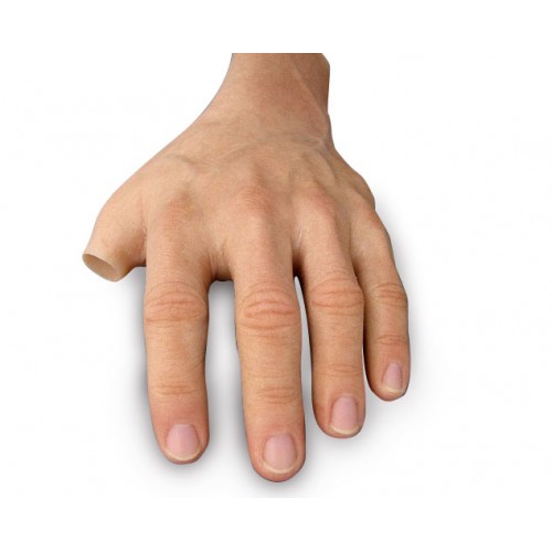 Πρόθεση τμήματος παλάμης εξατομικευμένης κατασκευής Πρόθεση τμήματος παλάμης εξατομικευμένης κατασκευής