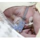 Ρινικό Cpap για βρέφη nCpap