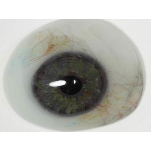 Τεχνητός Οφθαλμός Τεχνητός Οφθαλμός