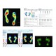 Foot Checker 42 X 42 2304 Αισθητήρων