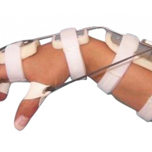 Νάρθηκας καρπού κάμψης της παλάμης Νάρθηκας καρπού κάμψης της παλάμης