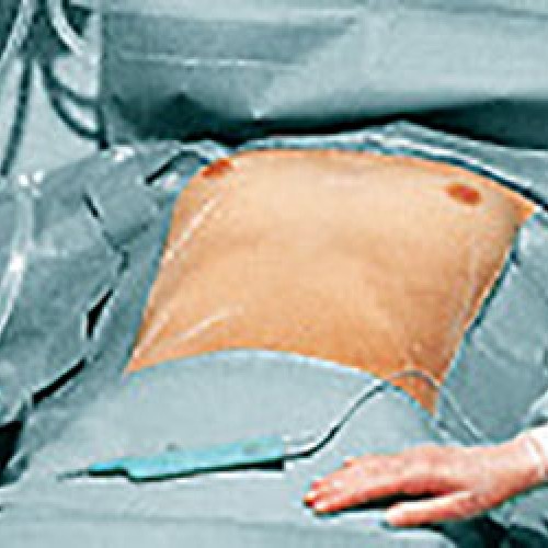 Χειρουργικά πεδία comfort με σχισμή και κάλυμμα περινεϊκής χώρας 200x260 cm  (12 τμχ.) Χειρουργικά πεδία comfort με σχισμή και κάλυμμα περινεϊκής χώρας 200x260 cm  (12 τμχ.)