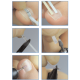 Onyclip Set Σύστημα Διόρθωσης Νυχιών