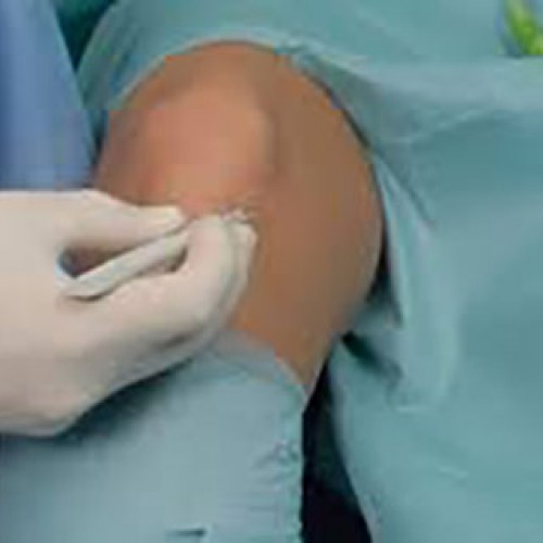 Χειρουργικά πεδία comfort αρθροσκόπησης 245x320cm 6τεμ. Χειρουργικά πεδία comfort αρθροσκόπησης 245x320cm 6τεμ.