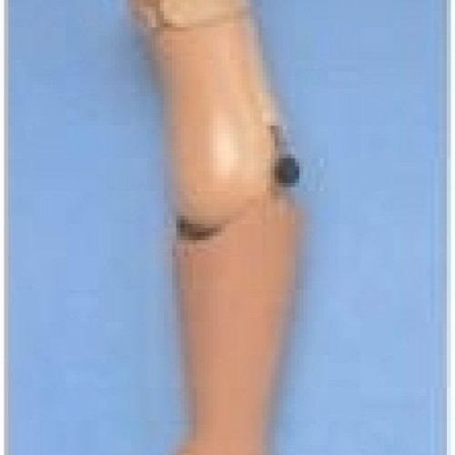 Πρόθεση βραχιονίου ή απεξάρθρωσης αγκώνα διακοσμητική Πρόθεση βραχιονίου ή απεξάρθρωσης αγκώνα διακοσμητική