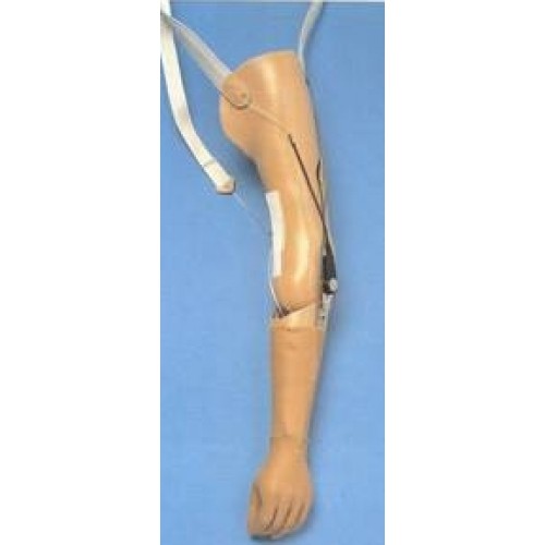 Προθέση βραχιονίου ή απεξάρθρωσης αγκώνα μηχανική Προθέση βραχιονίου ή απεξάρθρωσης αγκώνα μηχανική