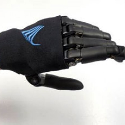 Ηλεκτρονική πρόθεση παλάμης ή δακτύλων - τμήματος παλάμης Vincent