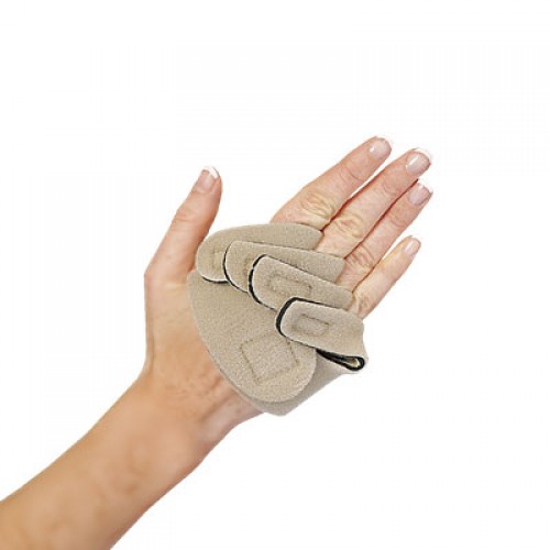 Νάρθηκας αρθρίτιδας "Ulnar Deviation" Νάρθηκας αρθρίτιδας "Ulnar Deviation"