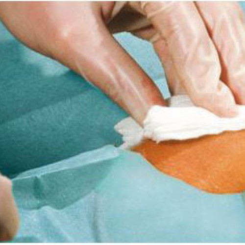 Χειρουργικά πεδία comfort με οπή 5cm (70 τμχ.) Χειρουργικά πεδία comfort με οπή 5cm (70 τμχ.)