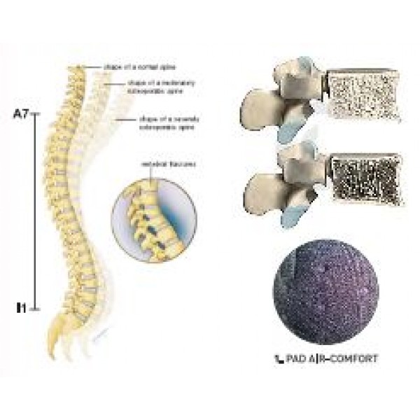 Νάρθηκας Θ.Ο.Μ.Σ.Σ με κορδόνι συμπίεσης SPINE S/M