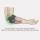 Δέστρα επικονδυλίτιδας (tennis elbow) με σιλικόνη CCA