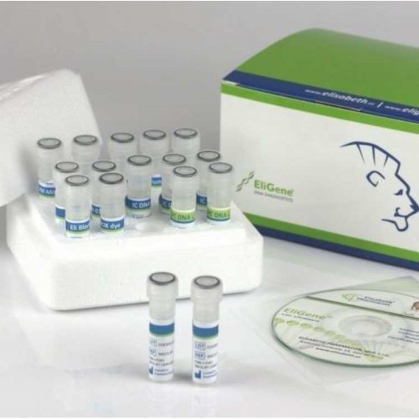 Πλήρες κιτ τεχνολογίας Real-time PCR για την ανίχνευση του ιού SARS-CoV-2 σε κλινικά δείγματα (100 test)