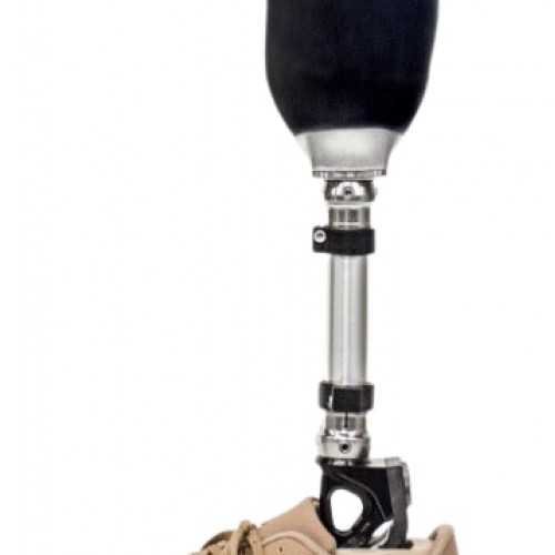 Πρόθεση κνήμης επιτόπιας κατασκευής και εφαρμογής σε μια ώρα "Amparo"