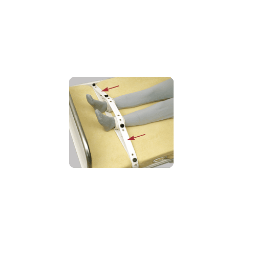 Ιμάντας πρόσθετης στήριξης σε υπάρχον σύστημα SEGUFIX