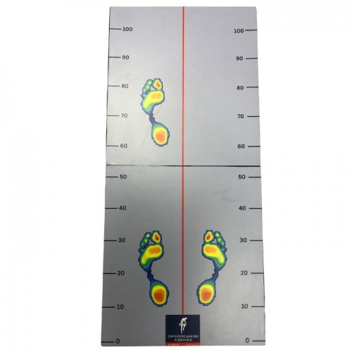 Προέκταση πελματογράφου