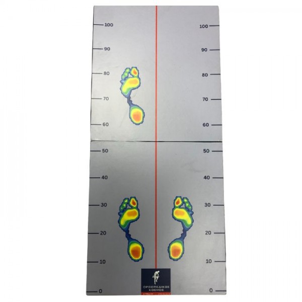 Προέκταση πελματογράφου