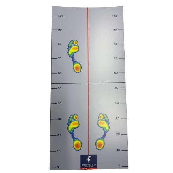 Προέκταση πελματογράφου